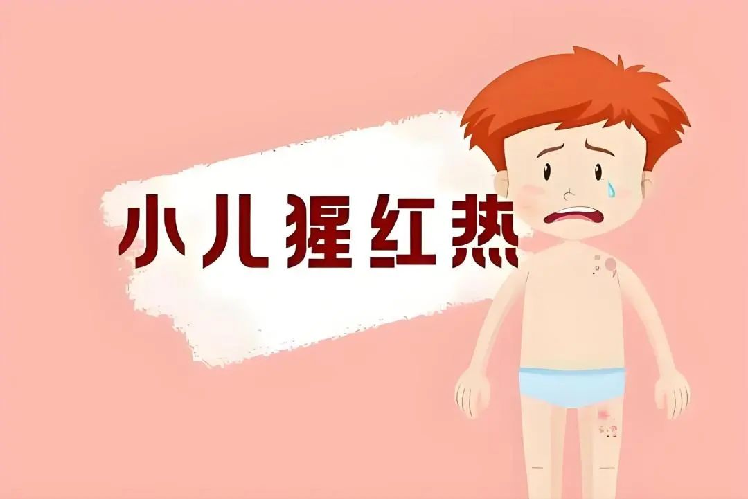 揭开猩红热的神秘面纱：守护孩子健康的关键指南
