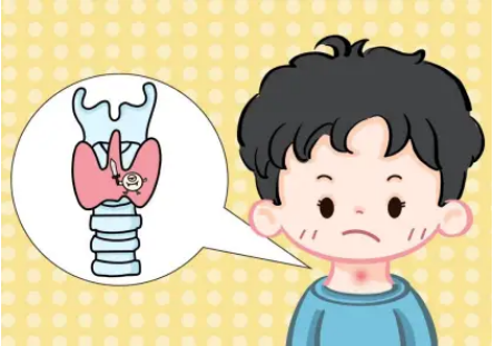 儿童桥本甲状腺炎的那点事