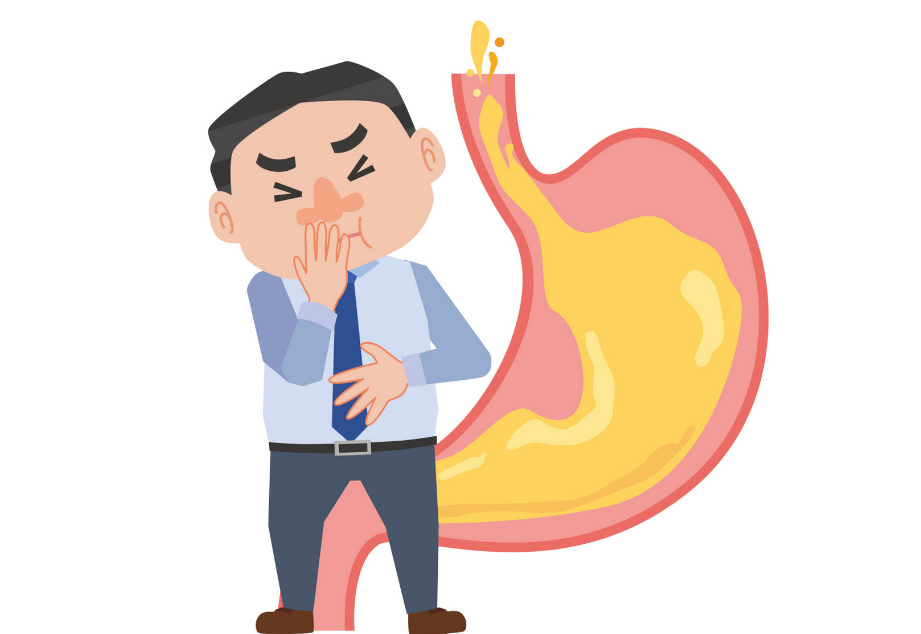 胃食管反流病：被忽视的“烧心病”，这些知识你必须知道