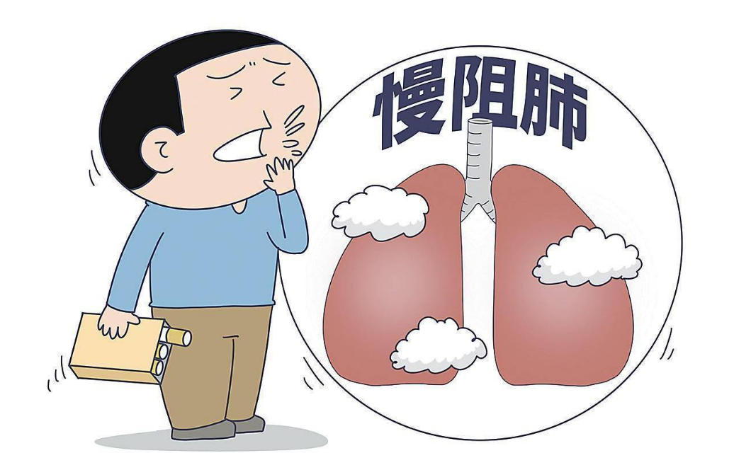慢阻肺的认识与科学防治