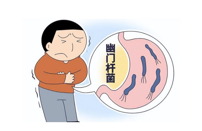 幽门螺杆菌的治疗与预防