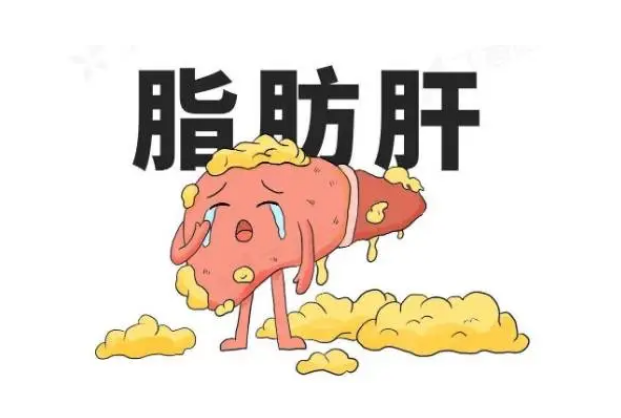 肝脏“甜蜜”的负担-脂肪肝，沉默的杀手