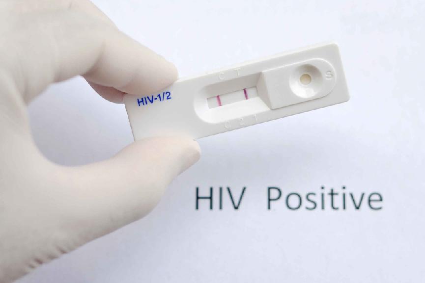 艾滋病到底是不是绝症？破除谣言，重拾希望