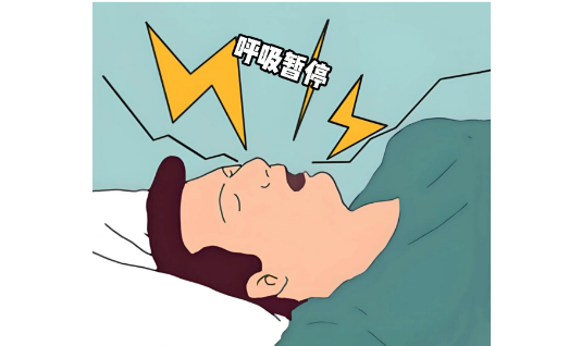 沉默的杀手-呼吸睡眠暂停综合征