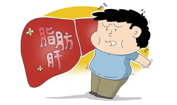 脂肪肝：沉默的肝脏“胖”危机，科学防治是关键