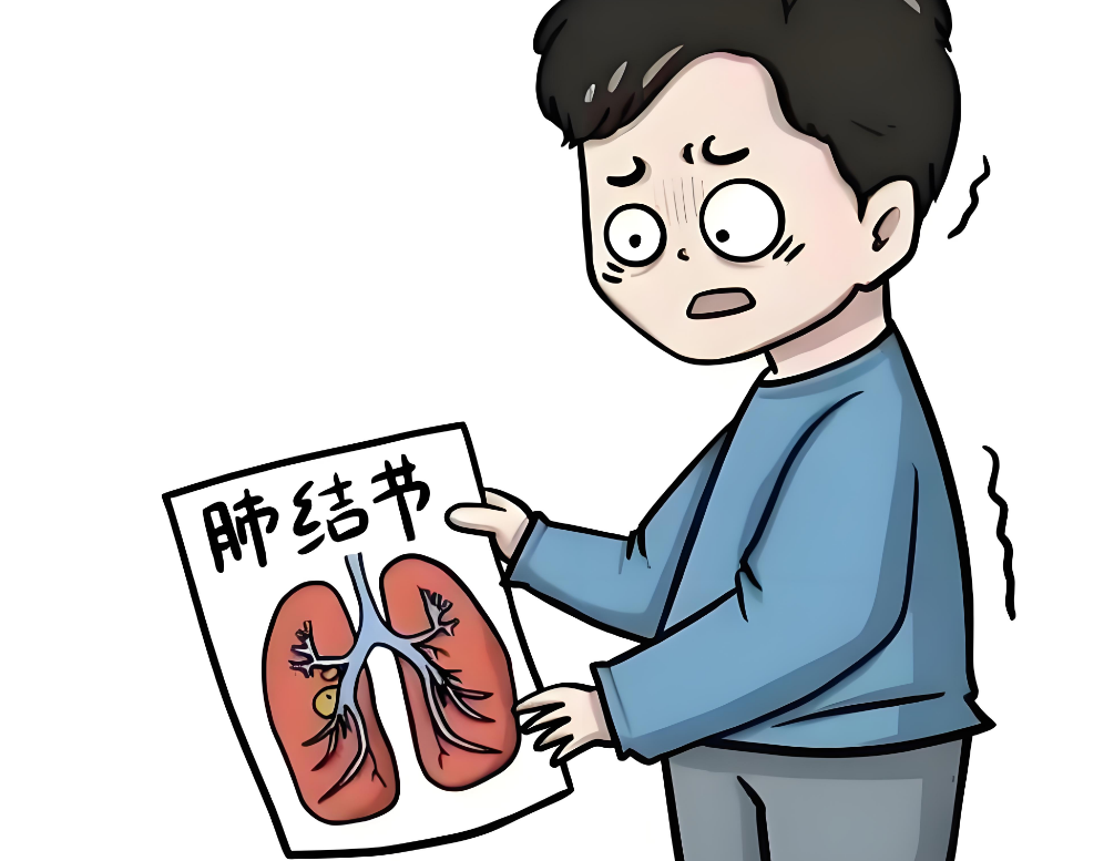 肺结节就是肺癌吗