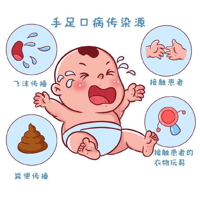 手足口病，你需要知道的这些事儿