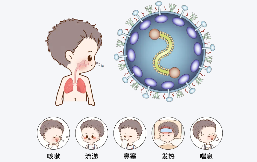 呼吸道合胞病毒感染：婴幼儿的“隐形杀手”