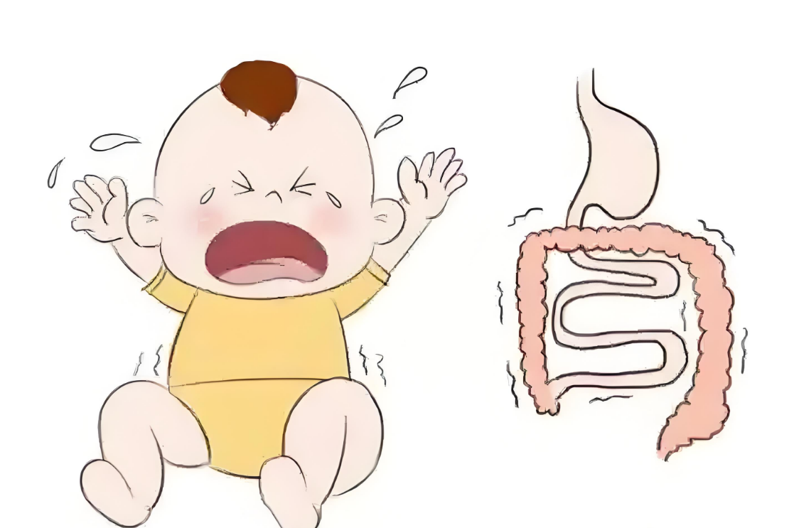 儿童炎症性肠病