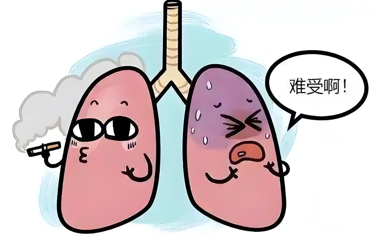 慢阻肺那些事