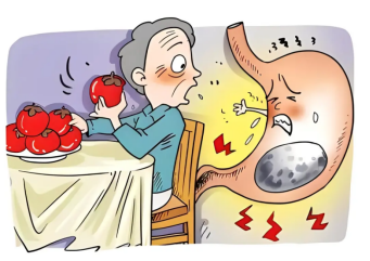 什么？胃里还能长石头？