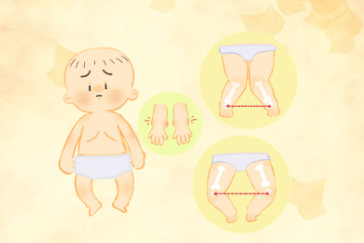 维生素D缺乏性佝偻病