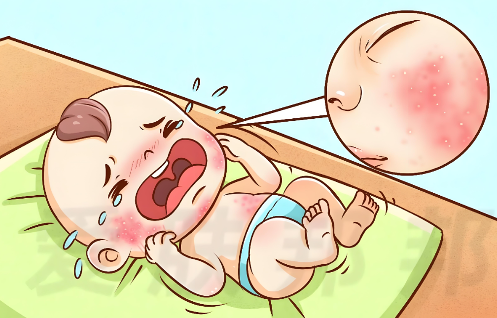 宝宝总&ldquo;闹&rdquo;肚子、长湿疹？科学应对牛奶蛋白过敏