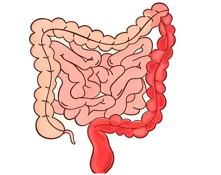 溃疡性结肠炎规范化全周期健康管理专业科普指南