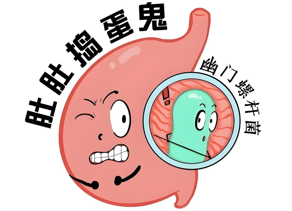 幽门螺杆菌科普