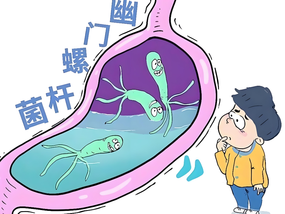科学彻底拔除幽门螺旋杆菌