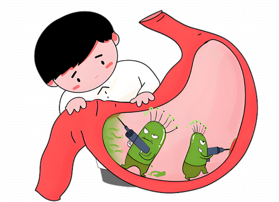 幽门螺杆菌：一人感染，全家警惕？