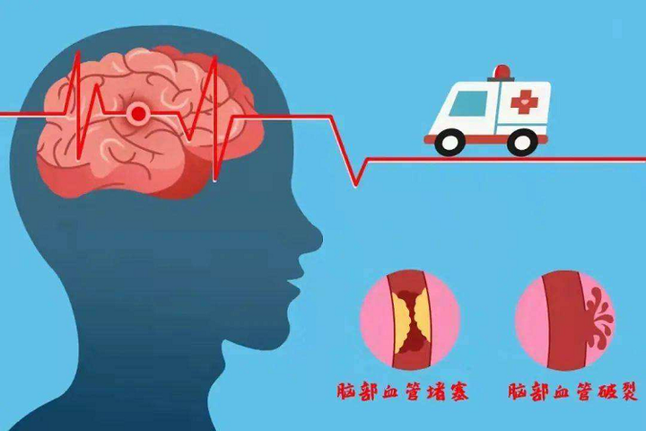 立秋后心血管病高发 三个防护雷区要避开