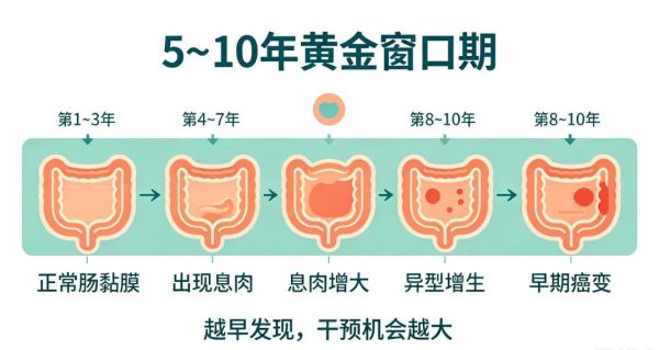 直肠癌往往是拖出来的！身体有这5种变化，及时就医