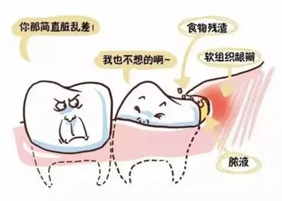 智齿00.jpg